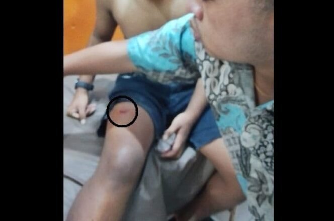 
					Luka Bacok di Paha dan Punggung, Remaja Perumnas Mandala Jalani Perawatan