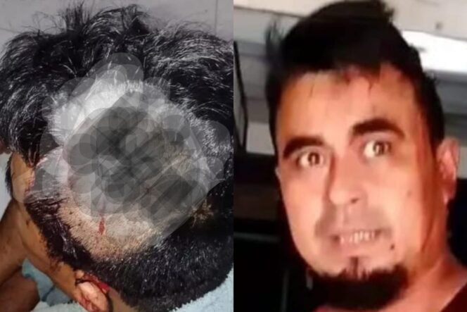 
					Ditusuk OTK di Teras Rumah, Warga Pagar Merbau Alami Luka Robek Kepala