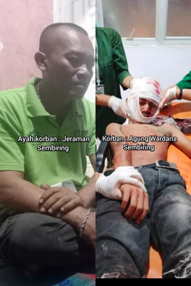
					Batok Kepala Pecah Dipasang Pelat, Habiskan Biaya Rp130 Juta: Harapan Korban Pembacokan Jadi Anggota TNI Gugur, Keluarga Menuntut Pelaku Segera Diringkus